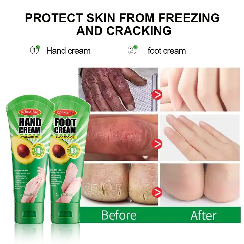 KORMESIC Avocad Hand Foot Chapped Cream Repair Cracked Heels Dry Cracked Feet Rescue Foot Cracks Split Heels Hard Skin & Cracks Heel Fissures Plantar Rhagades Painless Deep Skin Fissures Moisturizer