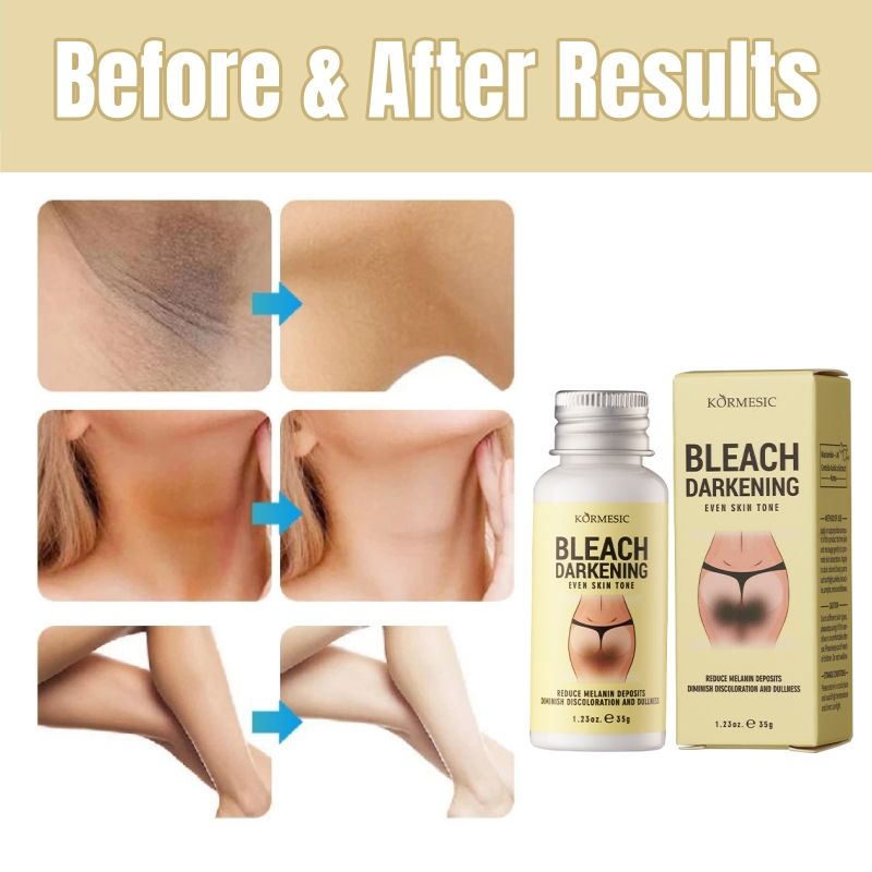 KORMESIC Niacinamide Body Whitening Cream Darkening Bleach Private Parts Underarm Inner Thigh Intimate Bleaching Serum Whiten Knee Butt Knuckles Brighten Cream Armpits Elbow Knees Joint Dark Spots