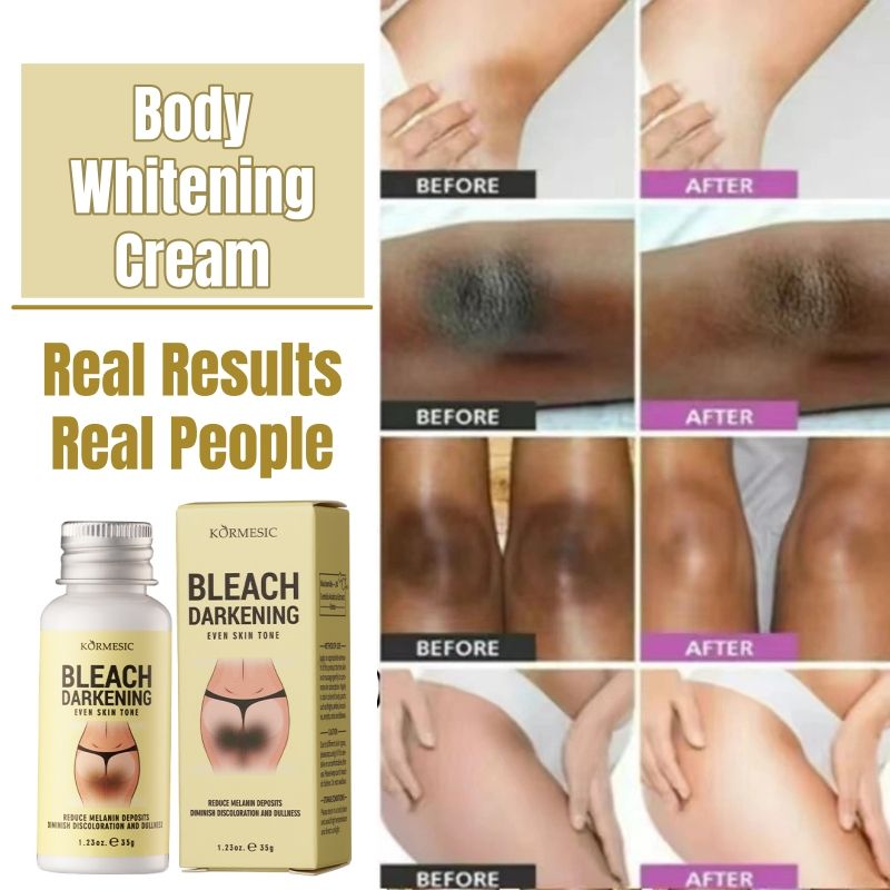 KORMESIC Niacinamide Body Whitening Cream Darkening Bleach Private Parts Underarm Inner Thigh Intimate Bleaching Serum Whiten Knee Butt Knuckles Brighten Cream Armpits Elbow Knees Joint Dark Spots