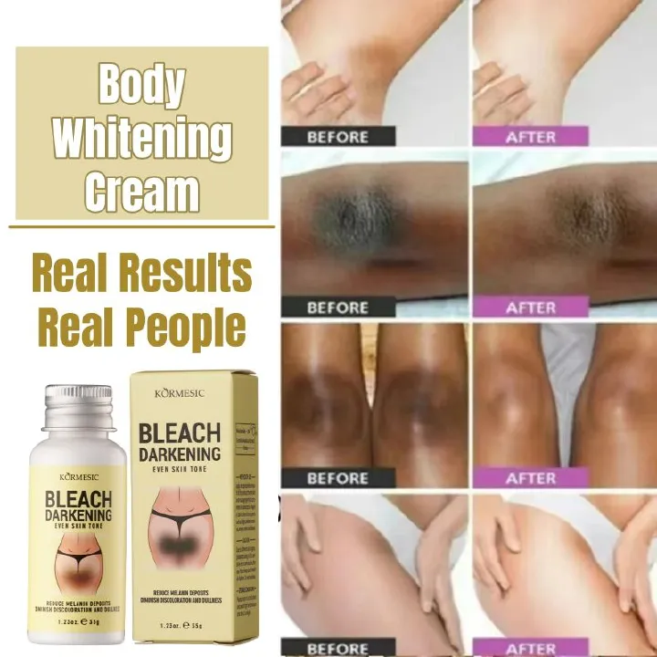 KORMESIC Niacinamide Body Whitening Cream Darkening Bleach Private Parts Underarm Inner Thigh Intimate Bleaching Serum Whiten Knee Butt Knuckles Brighten Cream Armpits Elbow Knees Joint Dark Spots