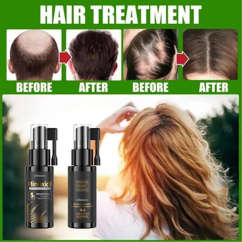 KORMESIC 5% Minoxidil & Biotin Hair Growth Serum Hair Regrowth Strengthen Hair Dual Action Anti Hair Loss Treatment Activates Hair Follicles for Thicker Stronger Hair Penetrating Fast Absorbing