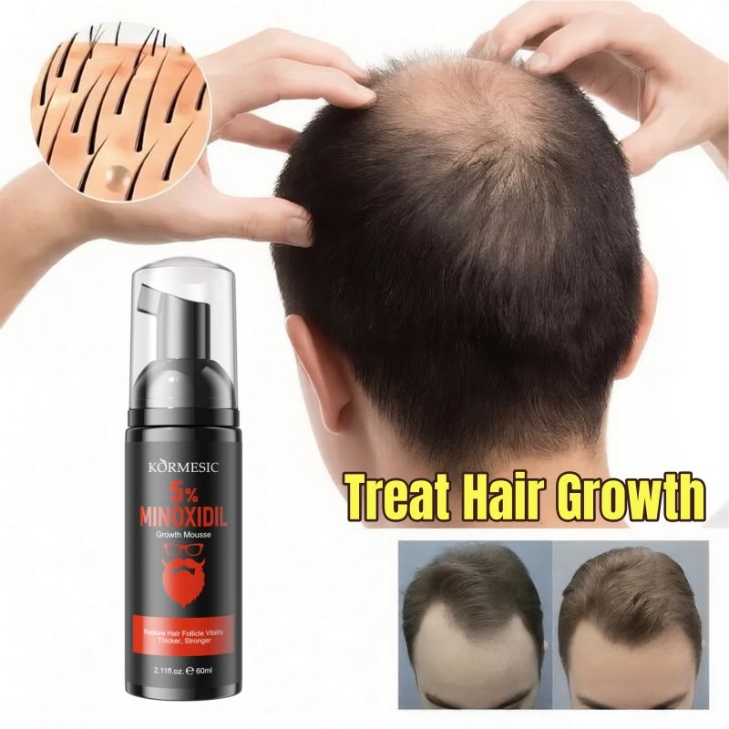 KORMESIC 5% Minoxidil Hair Beard Growth Foam Hair Regrowth Treatment Anti Hair Loss Activates Follicles Thicker Hair Fills Thin Spot Faster Hair Growth Strengthen Hair Stronger Hair Penetrating