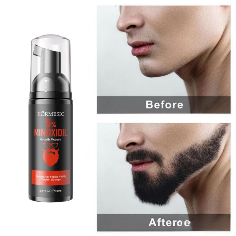 KORMESIC 5% Minoxidil Hair Beard Growth Foam Hair Regrowth Treatment Anti Hair Loss Activates Follicles Thicker Hair Fills Thin Spot Faster Hair Growth Strengthen Hair Stronger Hair Penetrating