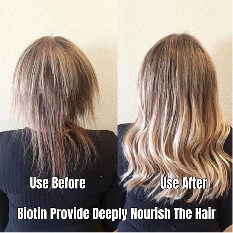 KORMESIC 2-in-1 Biotin Hair Essential Spray Oil Natural Ginger Extract Moisturizing Hair Deep Nourishing Hair Adds Shine Biotin Leave-In Treatment Repair Hair Damage Smooth Frizz Detangle Heat Protect