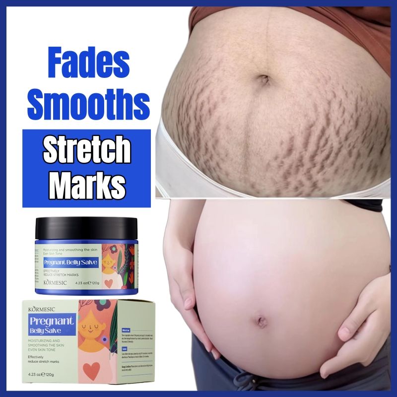 KORMESIC 100% Natural Herbal Stretch Mark Cream Reduces Stretch Marks Safe Mom Pregnancy Belly Cream Anti-Wrinkle Moisturizing Whitening Firms Skin Cell Regeneration Reduce Wrinkles Firm Wrinkled Skin