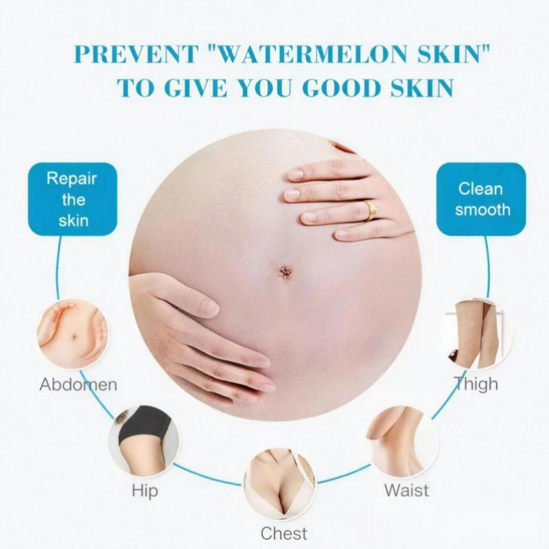 KORMESIC 100% Natural Herbal Stretch Mark Cream Reduces Stretch Marks Safe Mom Pregnancy Belly Cream Anti-Wrinkle Moisturizing Whitening Firms Skin Cell Regeneration Reduce Wrinkles Firm Wrinkled Skin