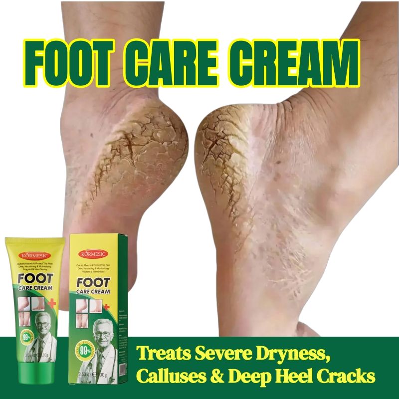 KORMESIC Feet Chapped Cream Repair Cracked Heels Dry Cracked Feet Rescue Foot Cracks Split Heels Hard Skin & Cracks Heel Fissures Plantar Rhagades Painless Deep Skin Fissures Moisturizer 100g