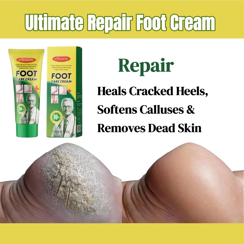 KORMESIC Feet Chapped Cream Repair Cracked Heels Dry Cracked Feet Rescue Foot Cracks Split Heels Hard Skin & Cracks Heel Fissures Plantar Rhagades Painless Deep Skin Fissures Moisturizer 100g