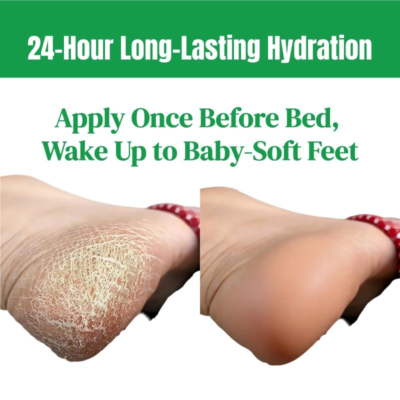 KORMESIC Feet Chapped Cream Repair Cracked Heels Dry Cracked Feet Rescue Foot Cracks Split Heels Hard Skin & Cracks Heel Fissures Plantar Rhagades Painless Deep Skin Fissures Moisturizer 100g