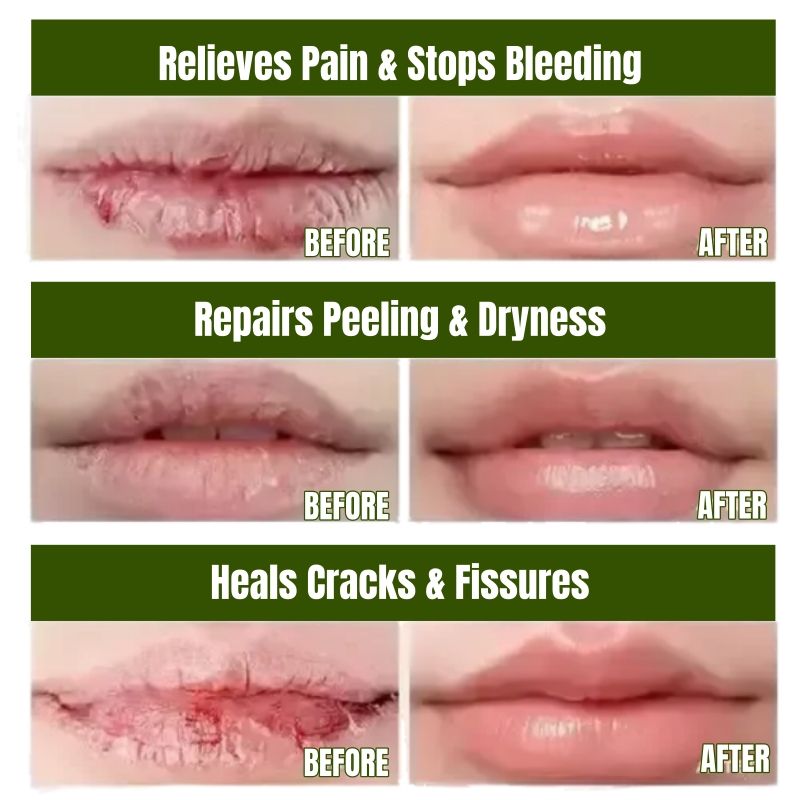 KORMESIC Natural Aloe Vera Lip Balm Moisturizing Hydrating Soothing Repair Dry Chapped Lips Soothes & Plumps Lips Reduces Lip Wrinkles & Restores Smoothness Non-Greasy Fast Absorbing Formula Lip Care