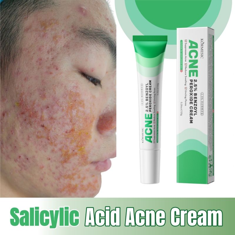 KORMESIC Salicylic Acid Acne Cream Arbutin Acne Treatment Cream Centella Asiatica Anti-Acne Cream Gently Reduces Redness Unclogs Pores Controls Oil Fades Dark Spots Smooth Clear Skin - Acne Prone Skin
