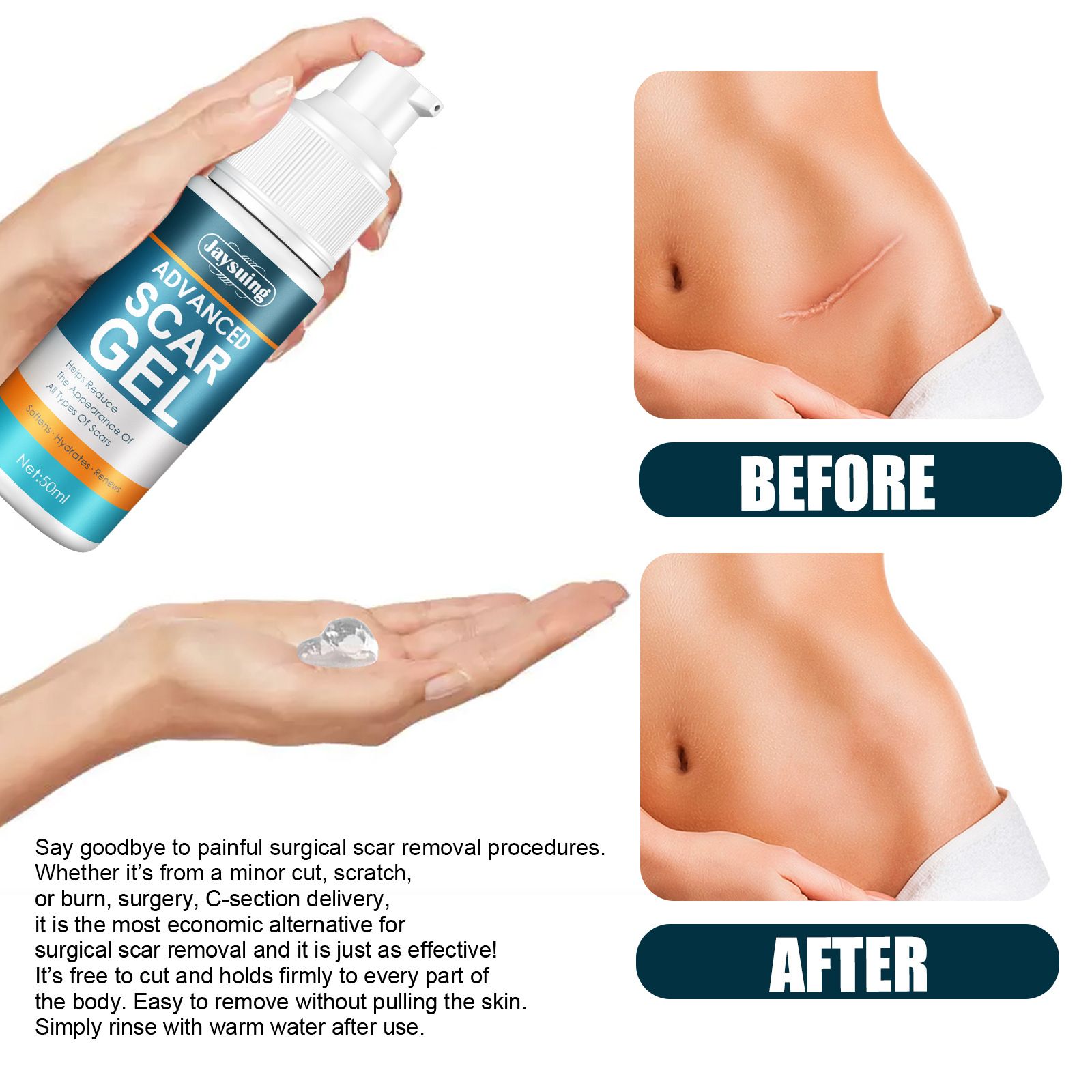 Scar Cream Silicone Scar Gel Medical Grade Scar Gel Facial Care Gel Pigmentation Corrector for Surgical skin Scars Hypertrophic Keloid C-Section Burn Old and New Scars Professional Scar Removal Gel