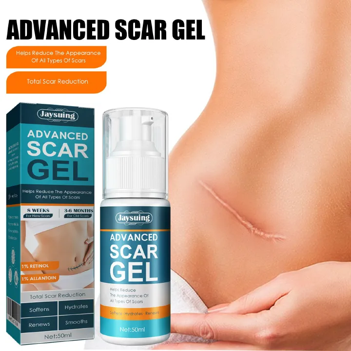 Scar Cream Silicone Scar Gel Medical Grade Scar Gel Facial Care Gel Pigmentation Corrector for Surgical skin Scars Hypertrophic Keloid C-Section Burn Old and New Scars Professional Scar Removal Gel