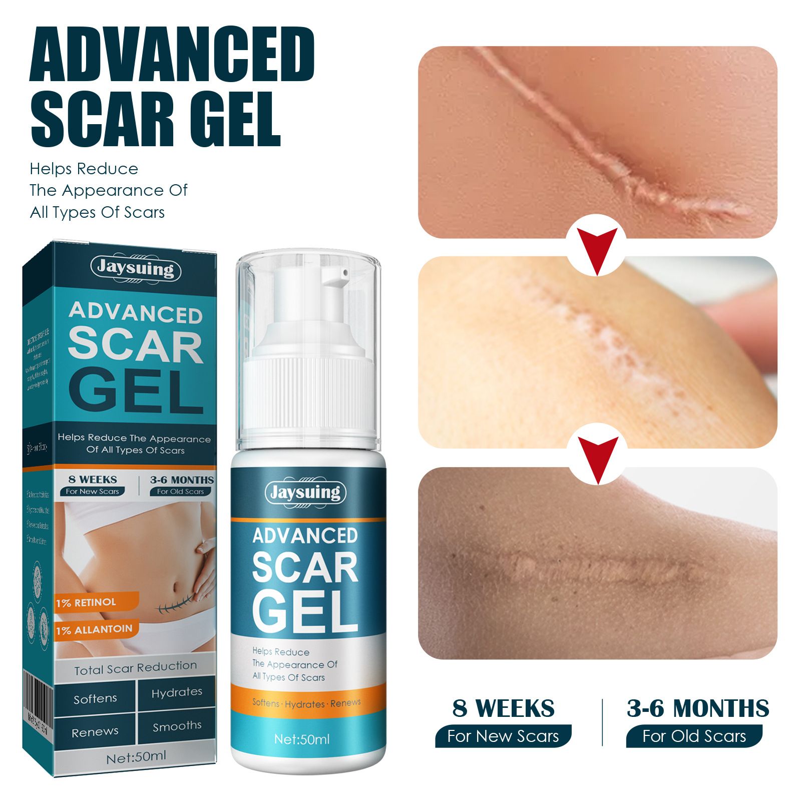 Scar Cream Silicone Scar Gel Medical Grade Scar Gel Facial Care Gel Pigmentation Corrector for Surgical skin Scars Hypertrophic Keloid C-Section Burn Old and New Scars Professional Scar Removal Gel