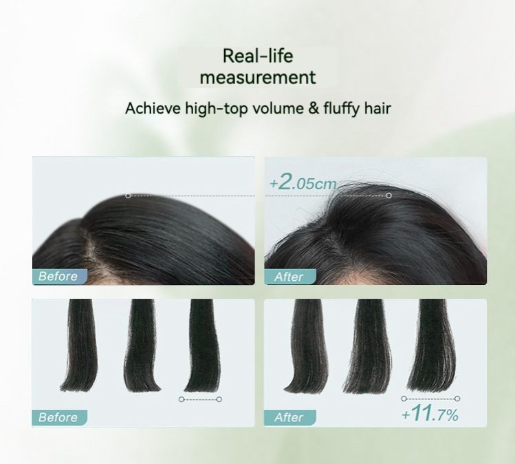 Best-selling shampoo for dandruff and itching control, oil-control and volumizing shampoo, hair care set, hair conditioner, shampoo and conditioner.