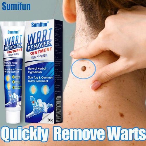 Sumifun Warts Remover Antibacterial Ointment Wart Treatment Cream Skin Tag Remover Herbal Extract Corn Plaster Warts Ointment