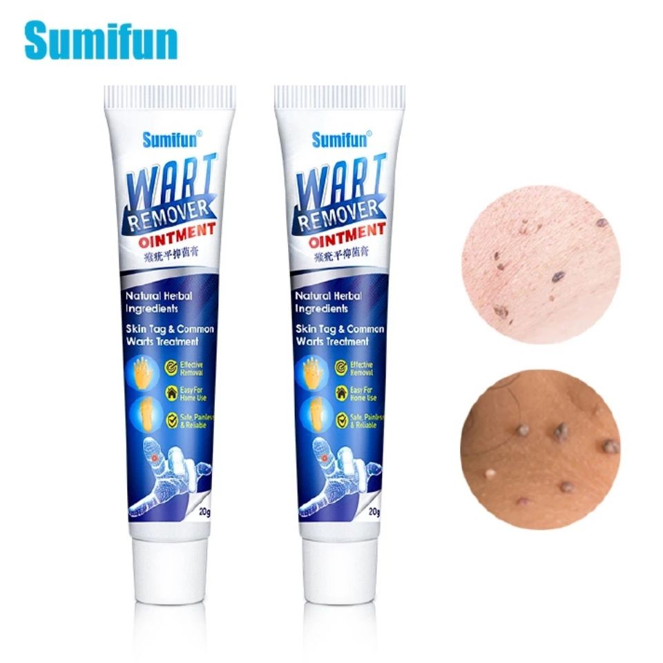 Sumifun Warts Remover Antibacterial Ointment Wart Treatment Cream Skin Tag Remover Herbal Extract Corn Plaster Warts Ointment