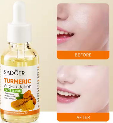 5-in-1 Sadoer Turmeric Skincare Set – Includes Turmeric Cleanser, Face Serum, Toner, Face Cream, and Turmeric Soap. Enriched with powerful Vitamin C, this all-in-one routine helps prevent acne, soothe