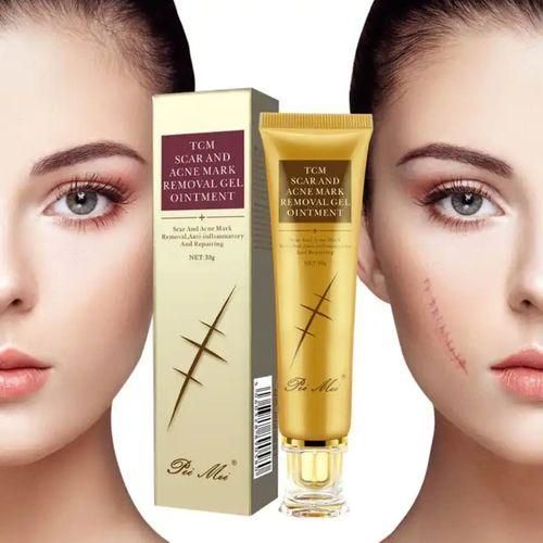 TCM Scar and Acne Mark Removal Gel Ointment Cream Removing Anti-inflammatory and Repairing - Pei mei