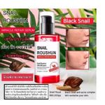 Roushun AHA BHA PHA Snail Miracle Repair Toner Anti-Acne Complex Dark Spot Correcting For Bright Clear Skin Calms Redness Post Acne Scars Marks Hyperpigmentation Sunburn Skin Damage Blemish Even Skin