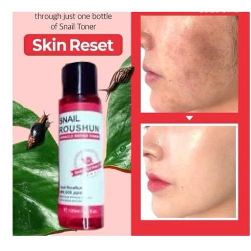 Roushun AHA BHA PHA Snail Miracle Repair Toner Anti-Acne Complex Dark Spot Correcting For Bright Clear Skin Calms Redness Post Acne Scars Marks Hyperpigmentation Sunburn Skin Damage Blemish Even Skin