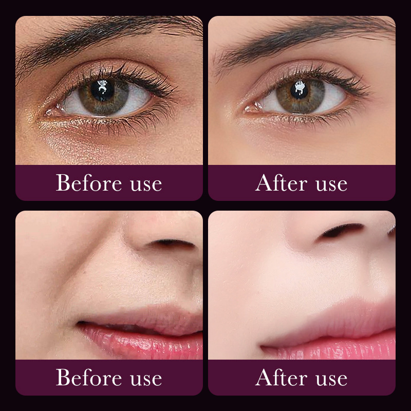 Snail Eye  Mask  SADOER Collagen Improves Dark Circles, Eye Lines,  and Eye Bags