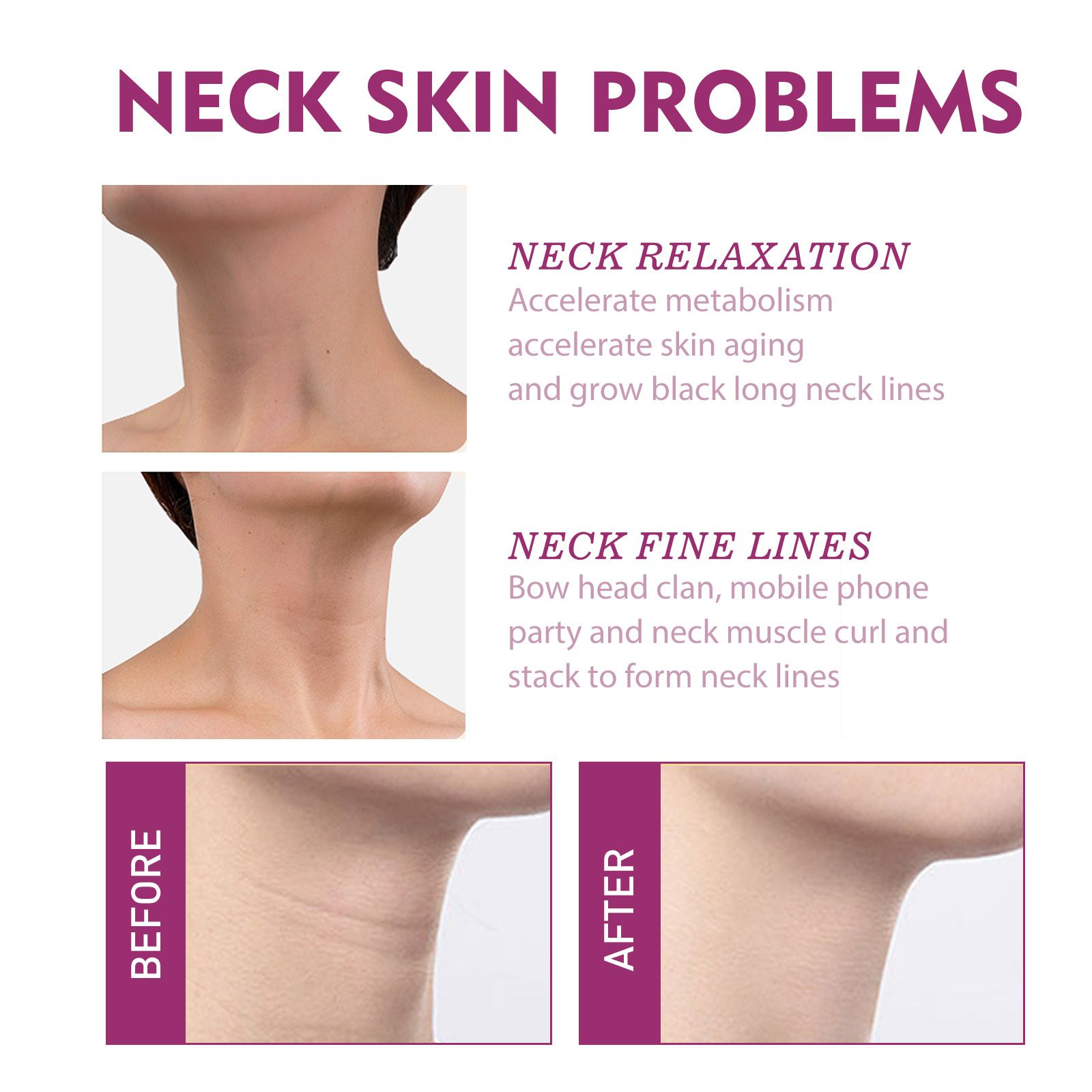 Jaysuing Hydrolyzed Collagen Neck Cream Gentle Care for Neck Skin, Moisturizing, Refreshing and Nourishing Massage Cream