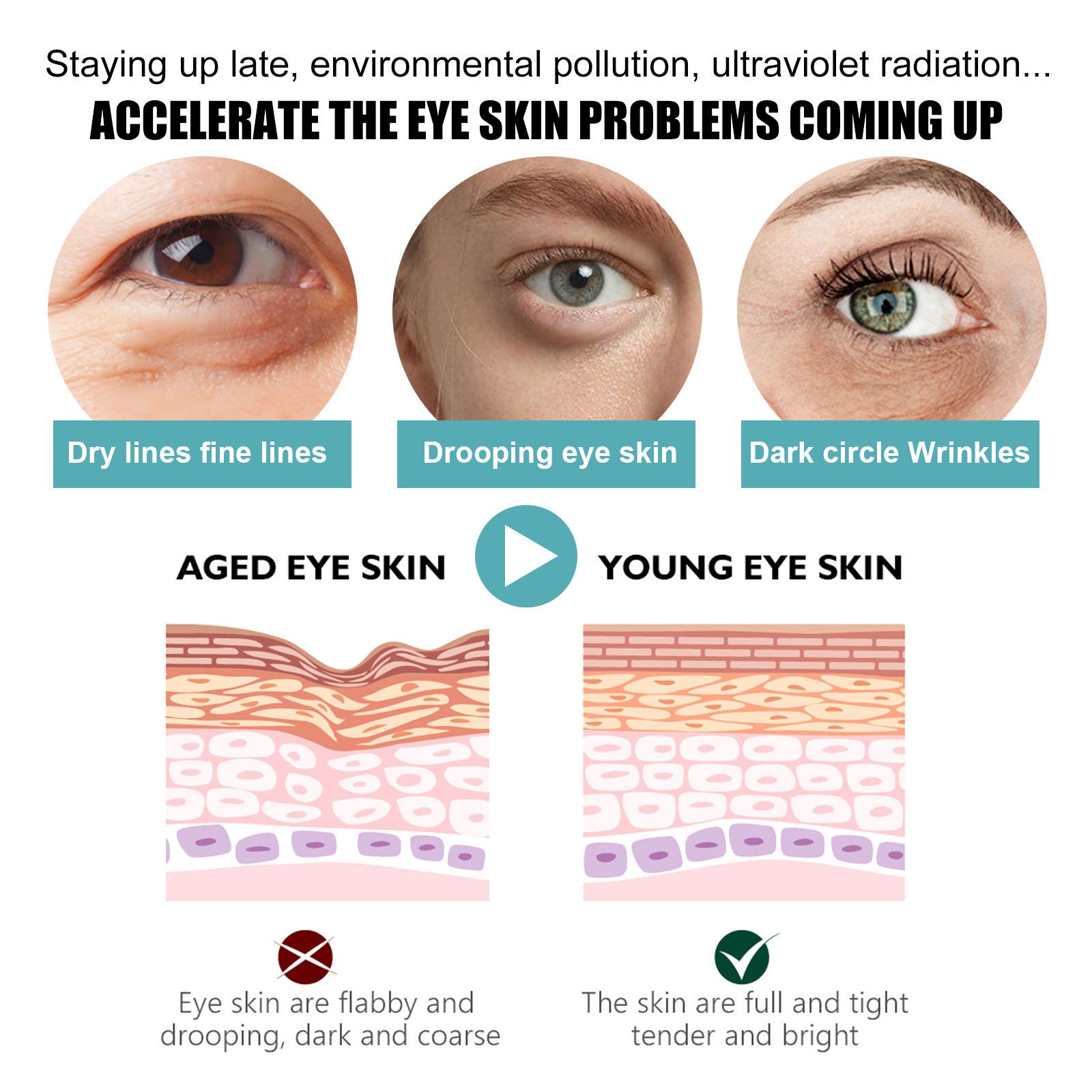 EELHOE Eye Care Cream Eye Area Skin Eye Corner Moisturizing Hydrating Nourishing Application Massage Care Eye Cream