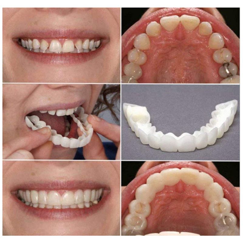 2Pcs/Set Silicone Whitening Teeth Braces, Upper Lower Teeth Cover, Simulation Denture B2-873