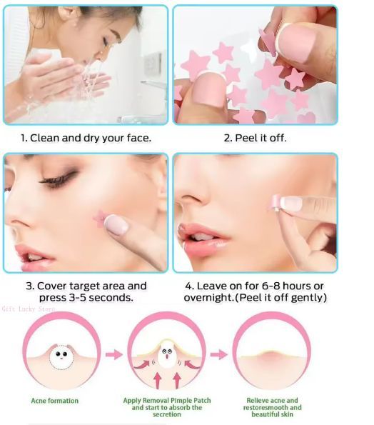 51PCS Acne Patch Facial Skin Care Fade Blemishes Pimple Marks Closed Acne Blemishes Cover Acne Pimple Repair Patch B2-1042