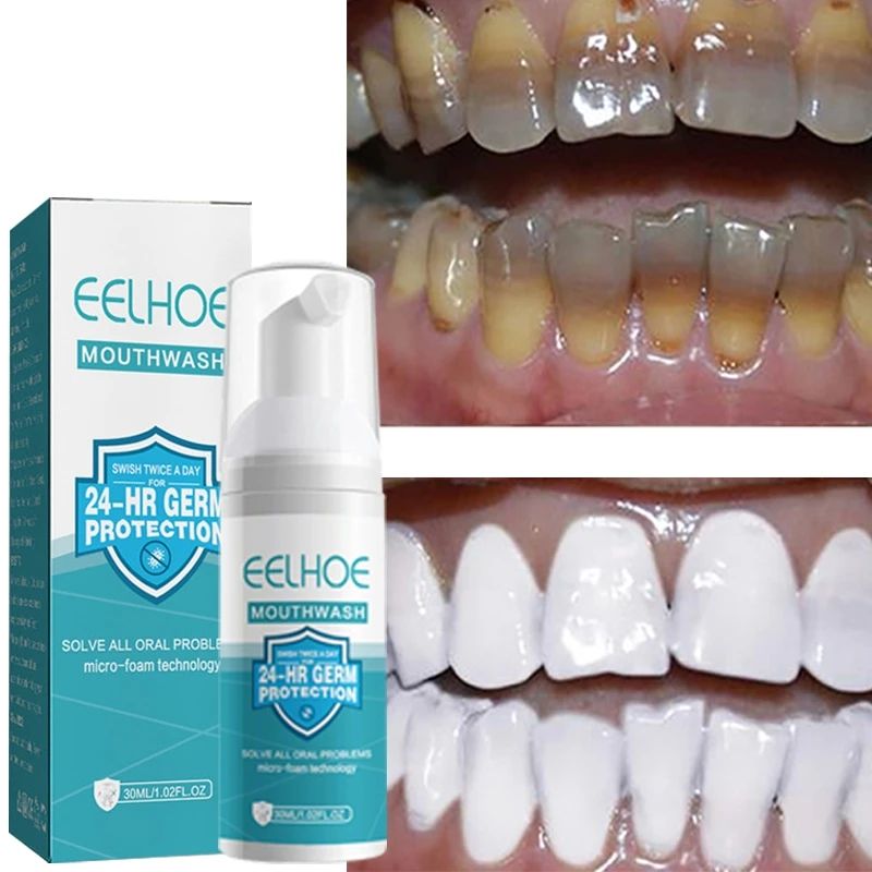 Teeth Whitening Mousse Deep Cleaning Dental Stains Plaque Repair Yellow Tooth Brightening Oral Gums Care Fresh Breath Toothpaste B2-858