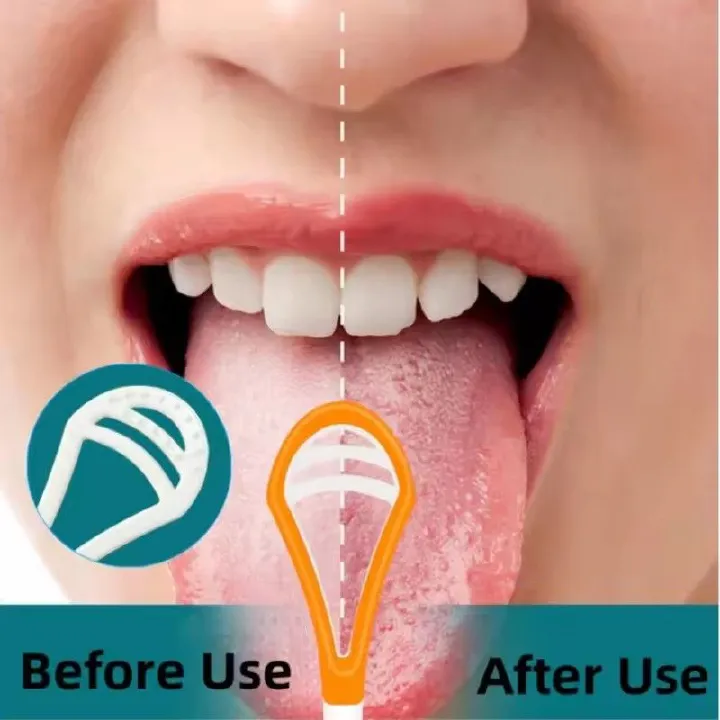 Tongue Cleaner for Professional Tongue Cleaner, Oral Care Tools, Adult Reusable Double-sided Tongue Cleaning Scraper Brush