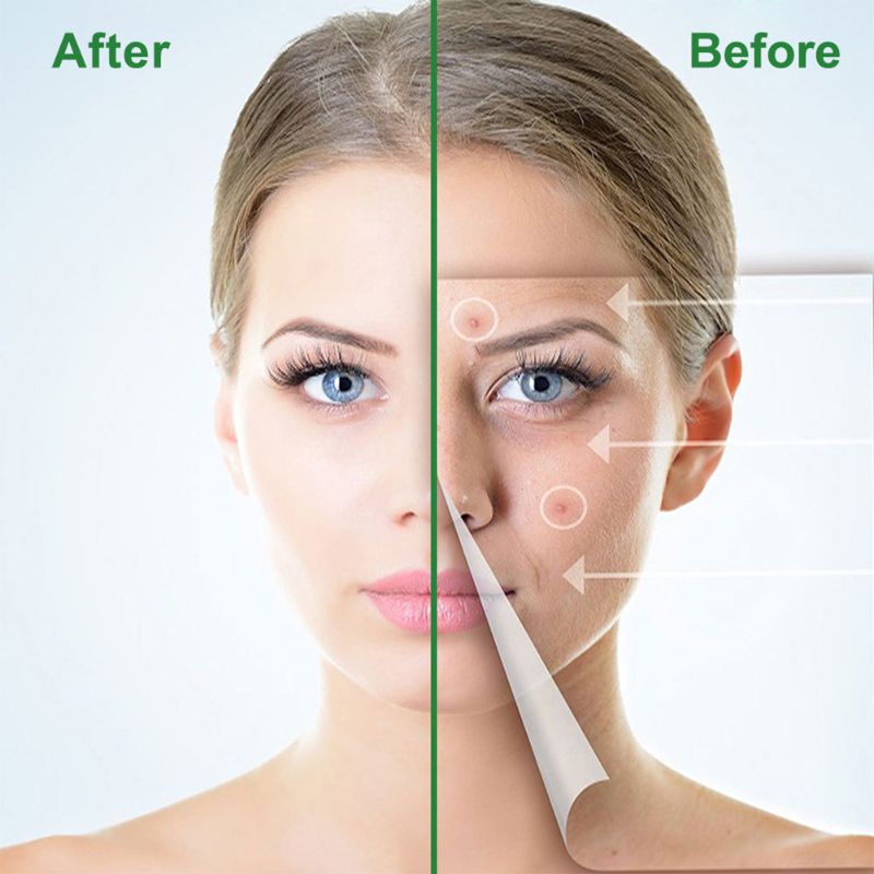 Pimple Remover Patch Stickers Acne Pimple Patch Stickers Invisible Acne Treatment Facial Skin Care Beauty ToolE-1287