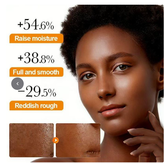 DR.DESS Turmeric Face Cream, Anti Oxidation Turmeric Cream For Deep Moisturizing skin Prevents Acnes, Oil Control and Soothing, skin Repair