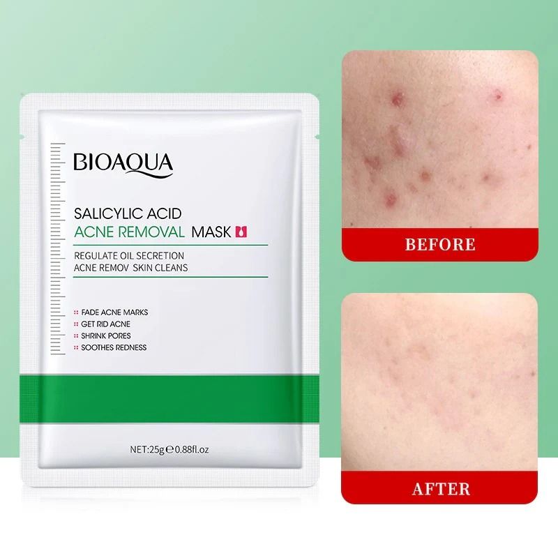 BIOAQUA Salicylic Acne Skin Care Face Masks Sheets,Acne Removal Mask Salicylic Acid Face Moisturizer,Pore Shrinkage Acne Skin Improves Acine Scars Motsturizing,Suitable for Oily, Acne Prone Skin