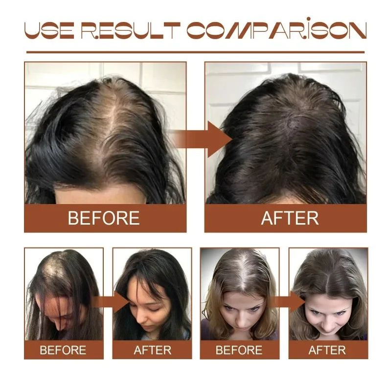 Natural 100% Pure Batana Oil Butter Hair Mask Anti Break Loss Hair Growth From Honduras Hair Loss Treatment For Black Men Women