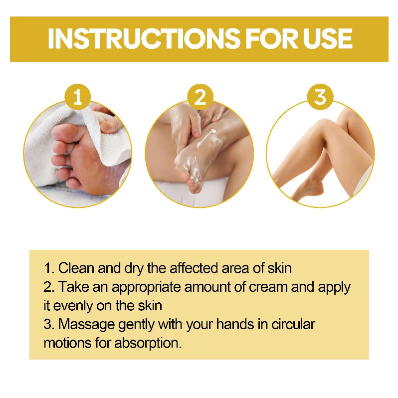 Bee Poison Varicose Vein Ease Paste, Spider Veins Ease For Legs Skin, Improve Blood Circulatio Healthy Gifts for Men & Women