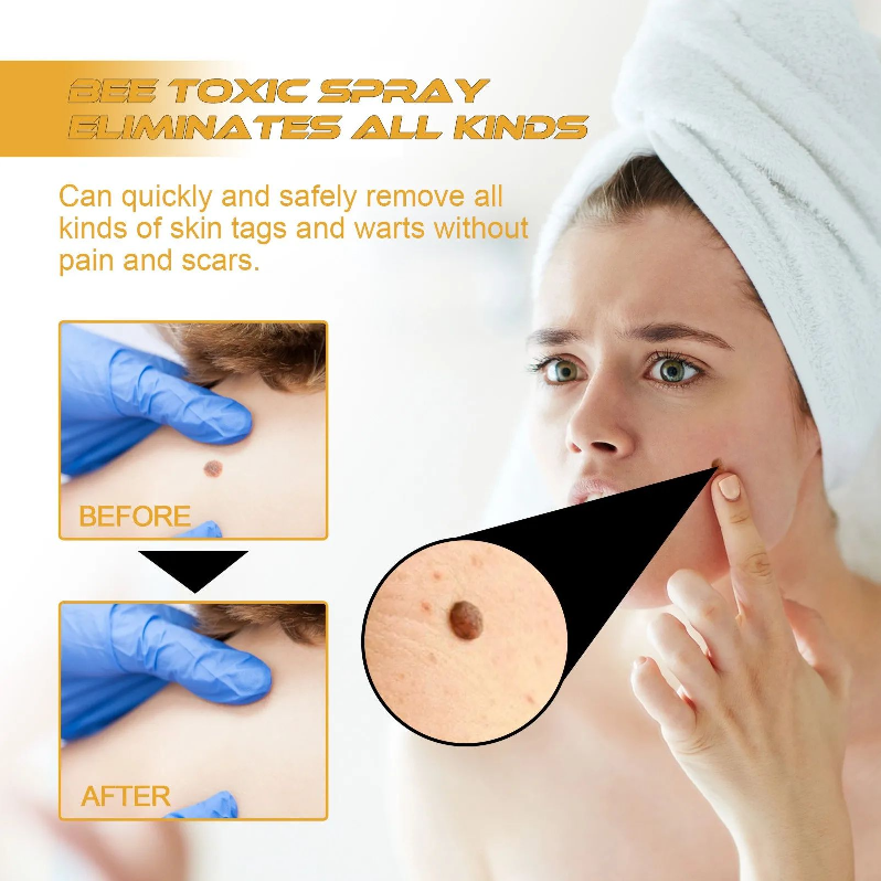 Bee 20ml Tag Recede Bee Spray Tagrecede Bee Spray For Skin.Safe For All Skin Types 2024 Gift Items Souvenirs Para Invitados