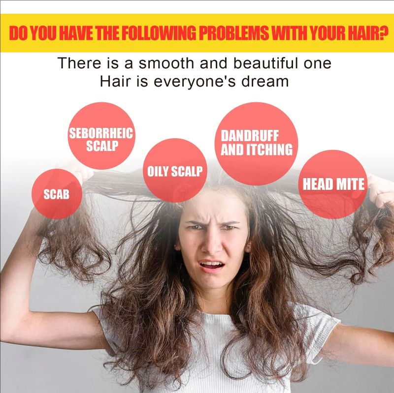 Sulphur Shampoo Itching Scalp Deep Clean Dandruff Long-Lasting Oil Control Strengthening Repair Improve Growth Hair Care Shampoo