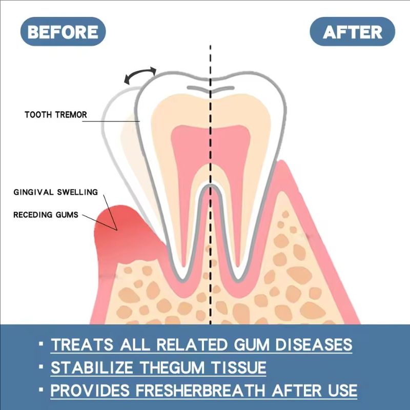 Rapid Repair Gums Serum Effectively Relieve Tooth Allergy Dental Caries Tooth Cleaning Toothpaste Relieve Tooth Damage Drops