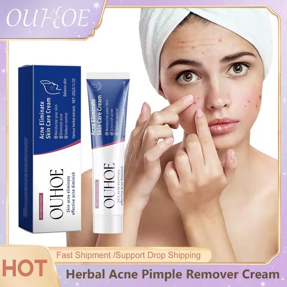 Pimple Acne Treatment Face Cream Nourish Balance Oil Control Refreshing Repair Pimple Remover Acne Cleansing Cream 20g/pc