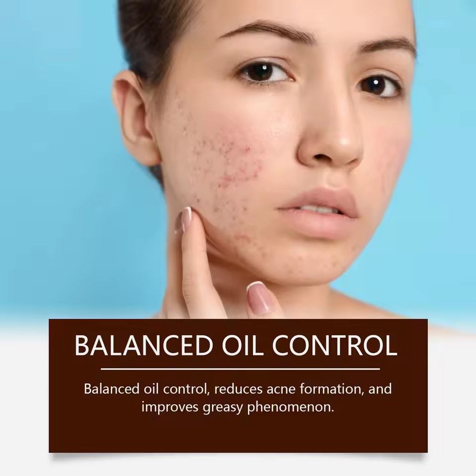Pimple Acne Treatment Face Cream Nourish Balance Oil Control Refreshing Repair Pimple Remover Acne Cleansing Cream 20g/pc