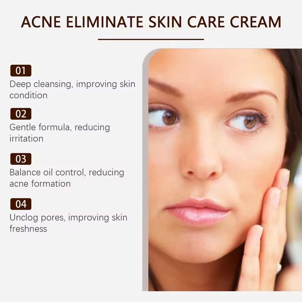 Pimple Acne Treatment Face Cream Nourish Balance Oil Control Refreshing Repair Pimple Remover Acne Cleansing Cream 20g/pc