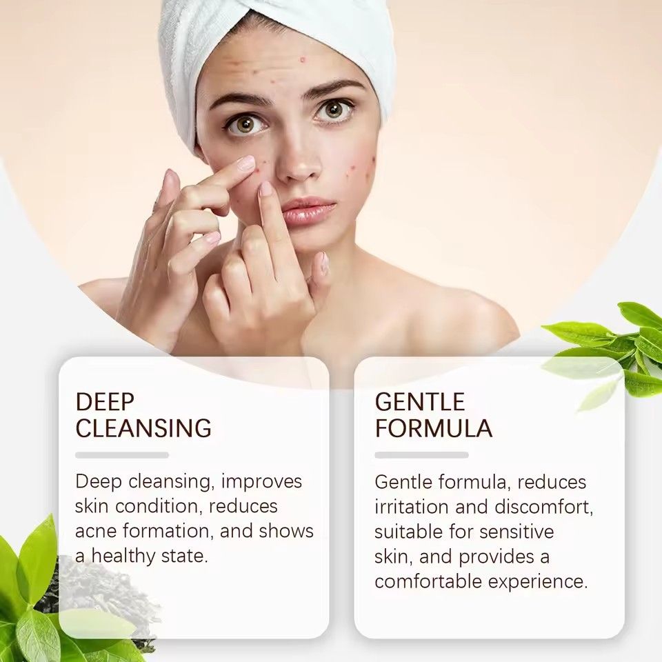 Pimple Acne Treatment Face Cream Nourish Balance Oil Control Refreshing Repair Pimple Remover Acne Cleansing Cream 20g/pc