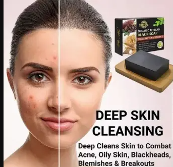 Organic African Black Soap With Cocoa Butter & Vitamin E -120g