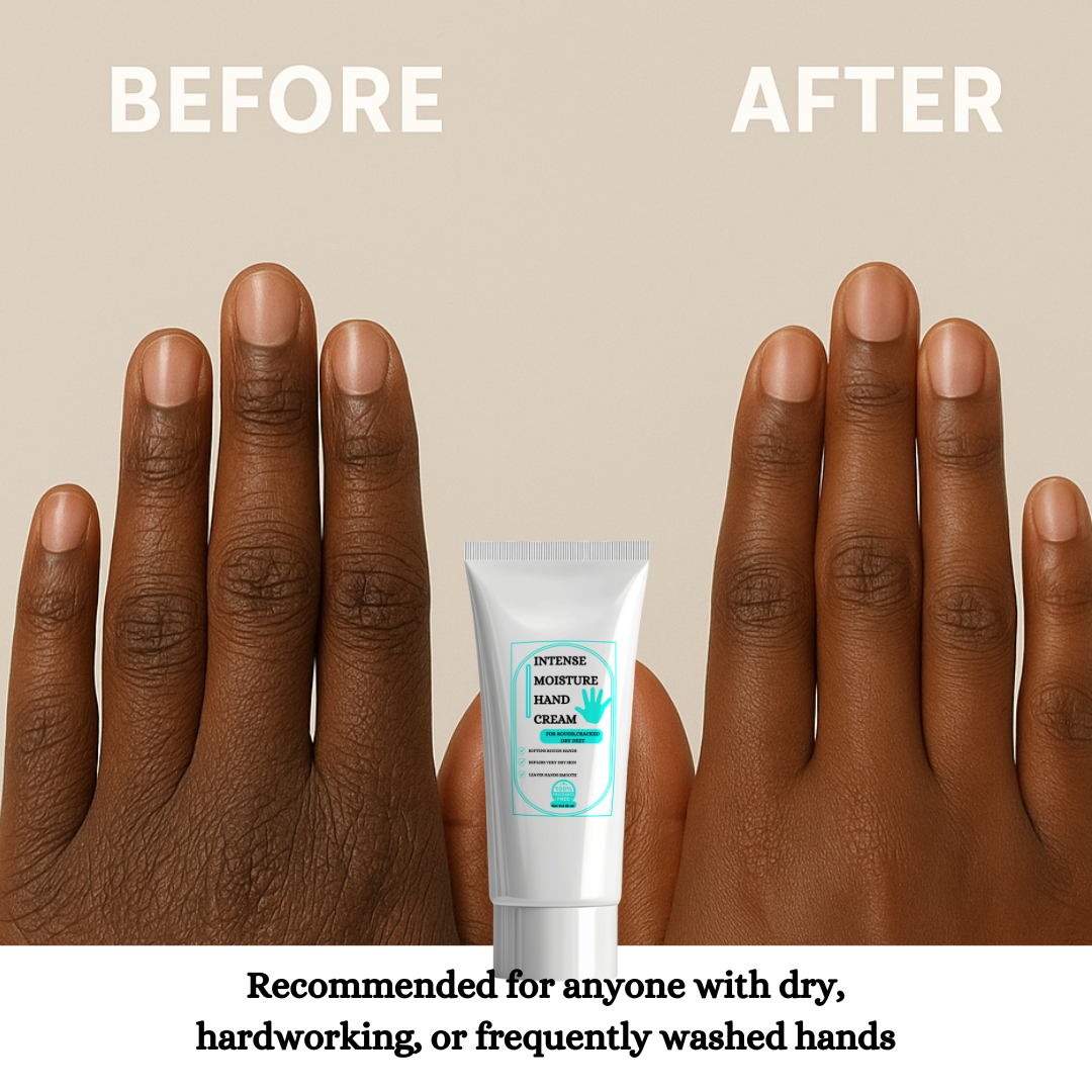 Intense Moisture Hand Cream - For Dry, Rough & Cracked Hands,Fragrance Free