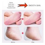 Double Sided Feet Rasp Foot Files Scrubber Callus Remover and Pumice Stone Pedicure