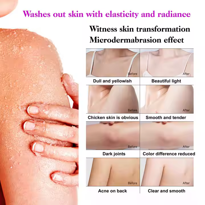 ROUSHUN Gluta Berry Scrub Shower Gel 1000ml Clean Skin Moisten Water Replenishing Long Lasting Fragrance Whitening Bubble Exfoliator Firms, Brightens, Moisturizes, Fade Dark Spots, Lightens 1000ml