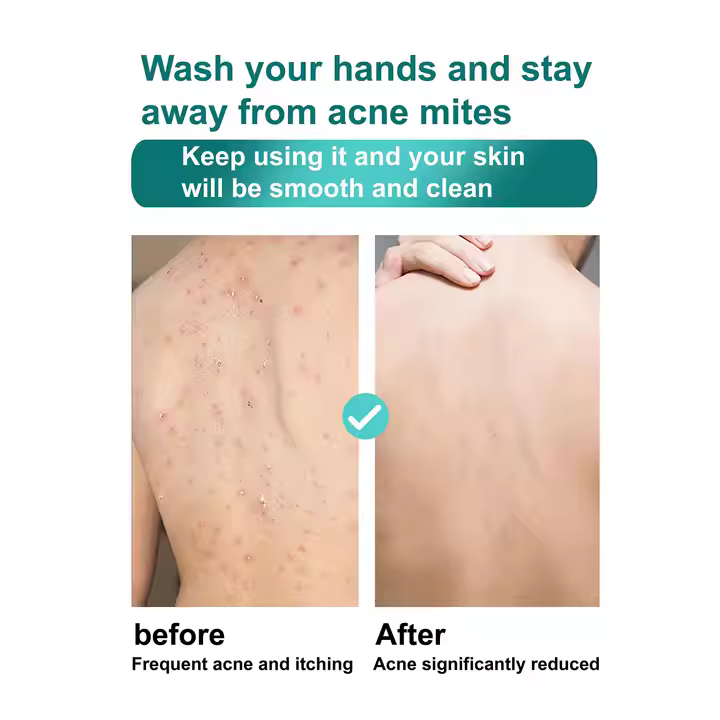 ROUSHUN Gluta Berry Scrub Shower Gel 1000ml Clean Skin Moisten Water Replenishing Long Lasting Fragrance Whitening Bubble Exfoliator Firms, Brightens, Moisturizes, Fade Dark Spots, Lightens 1000ml