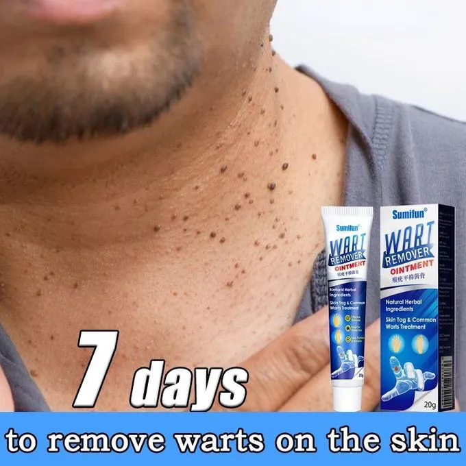 Warts Remover Skin Tag Remover Cream Warts Treatment Ointment Foot Corn Antibacterial Moles Warts Ointment - Sumifun-